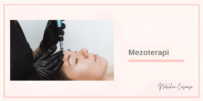 Mezoterapi Tedavisi