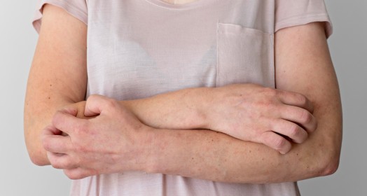 Atopik Dermatit Nedir? Tanı ve Tedavi Yöntemleri Nelerdir?