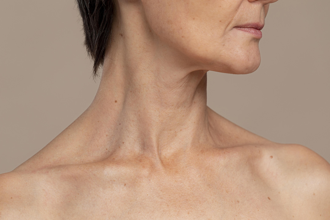 Boyun Gençleştirmede Dermatolojik Tedaviler