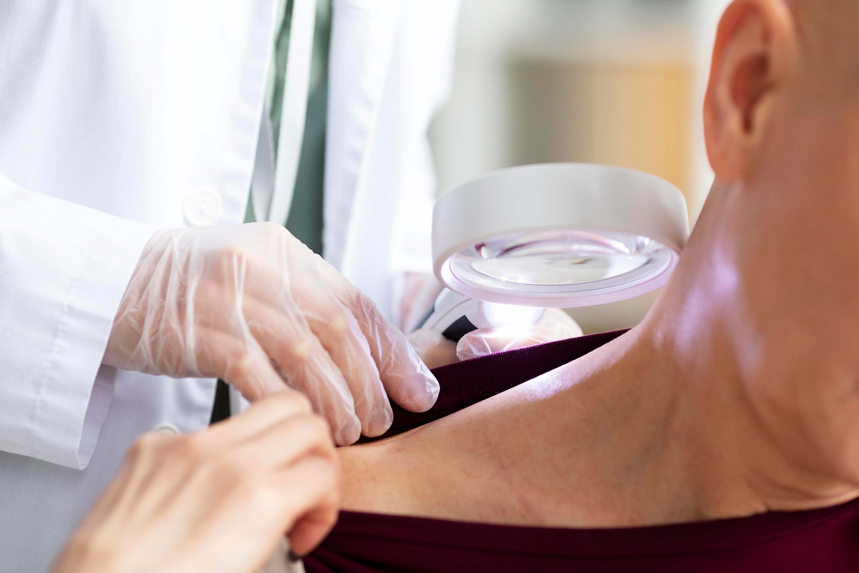 Dermatolog Nedir? Neye Bakar?