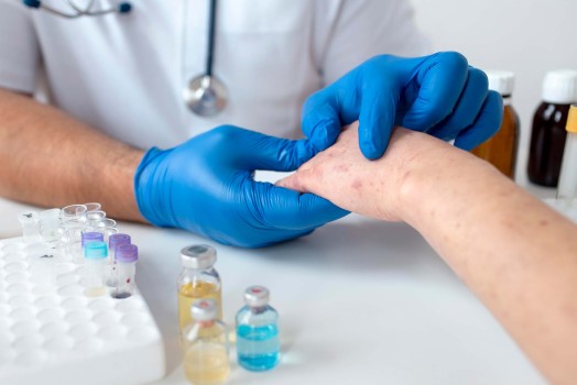 Dermatolojik Tedavi Yöntemleri Nelerdir?