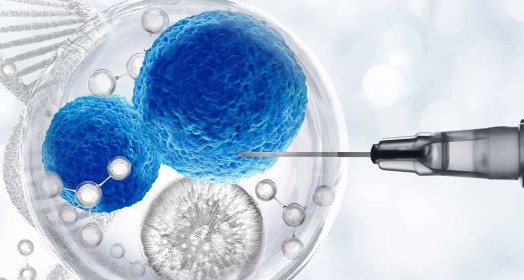 Fibrocell Otolog Fibroblast Tedavisi