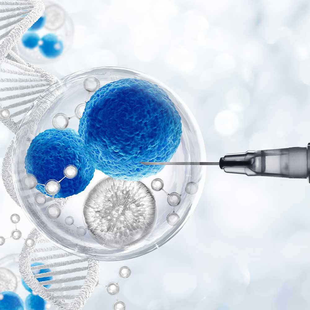 Fibrocell Otolog Fibroblast Tedavisi